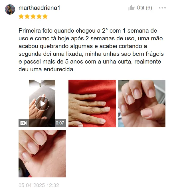 Unhas Saudáveis e Recuperadas